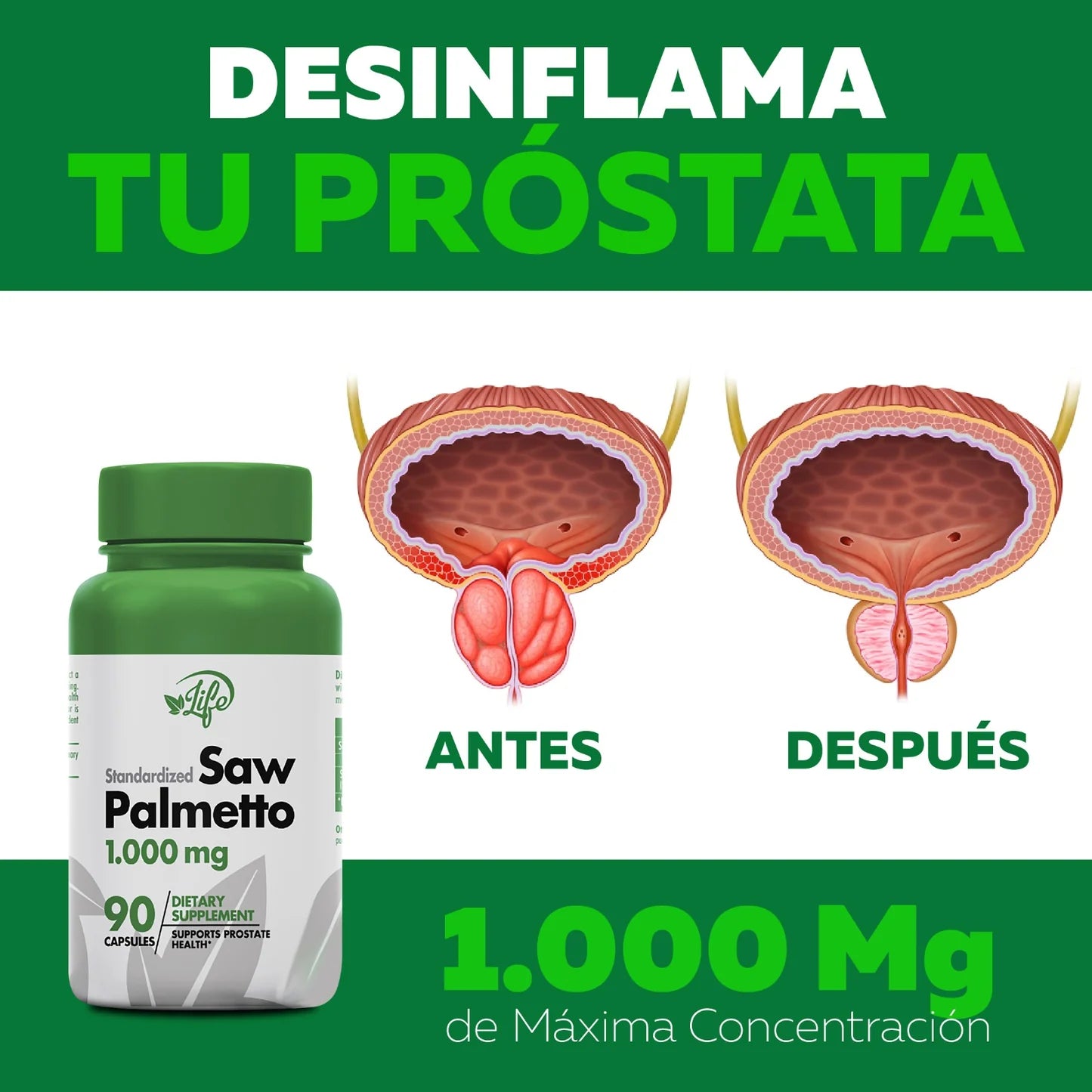 SAW PALMETTO 1000MG 90 CÁP.