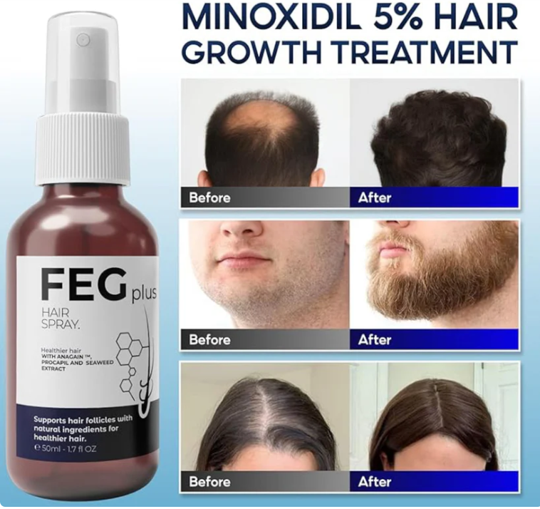 Spray Crecimiento del cabello